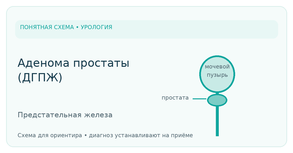 Схема для обсуждения лечения: Лечение аденомы простаты в Арзамасе